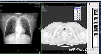 爱游戏体育：意甲阿斯科利的重建之路充满挑战的简单介绍